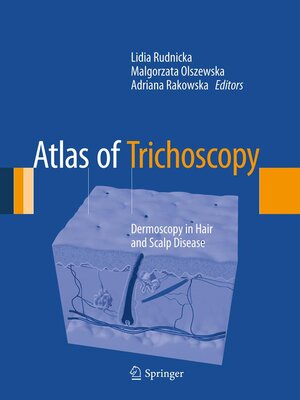 cover image of Atlas of Trichoscopy